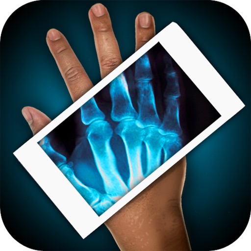Simulator X Ray Hand